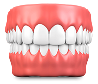 Cosmetic periodontics model